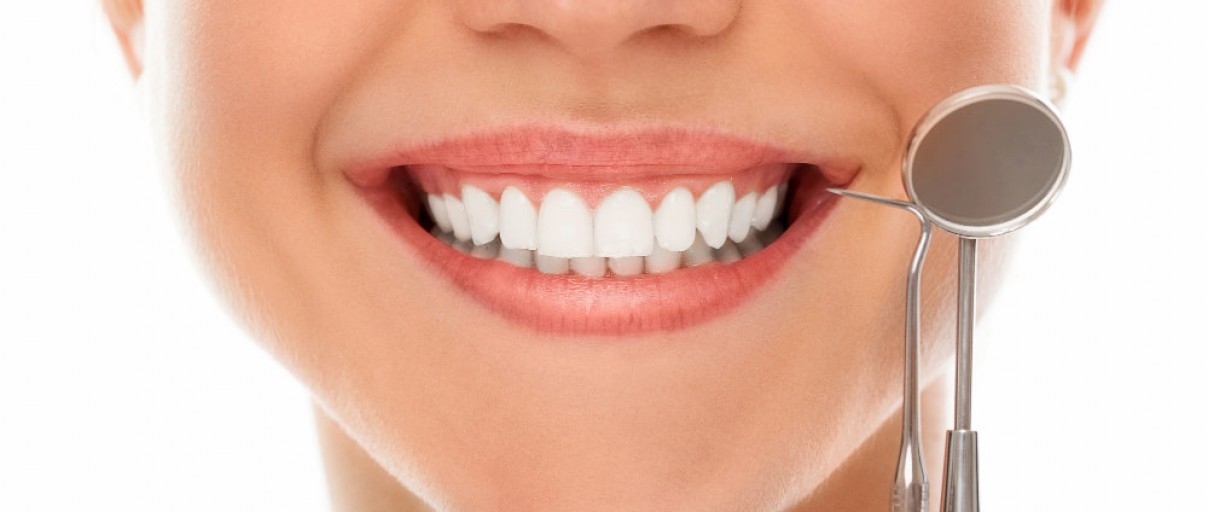 Lamine Diş Nedir? Porselen Diş Kaplama Nedir?