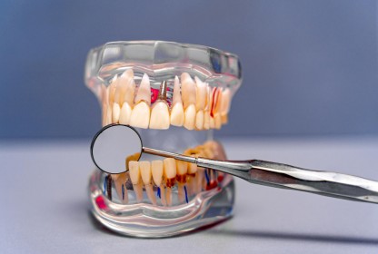 Ağız-Diş ve Çene Cerrahisi